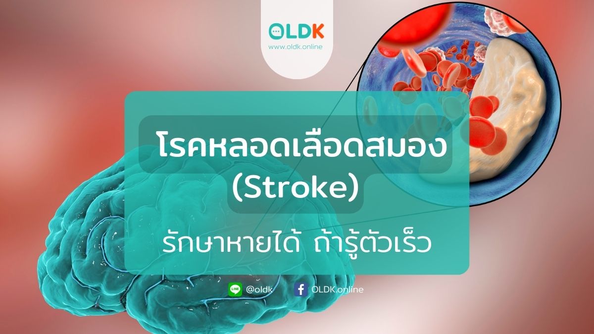 เส้นเลือดในสมองตีบ รักษาหายได้